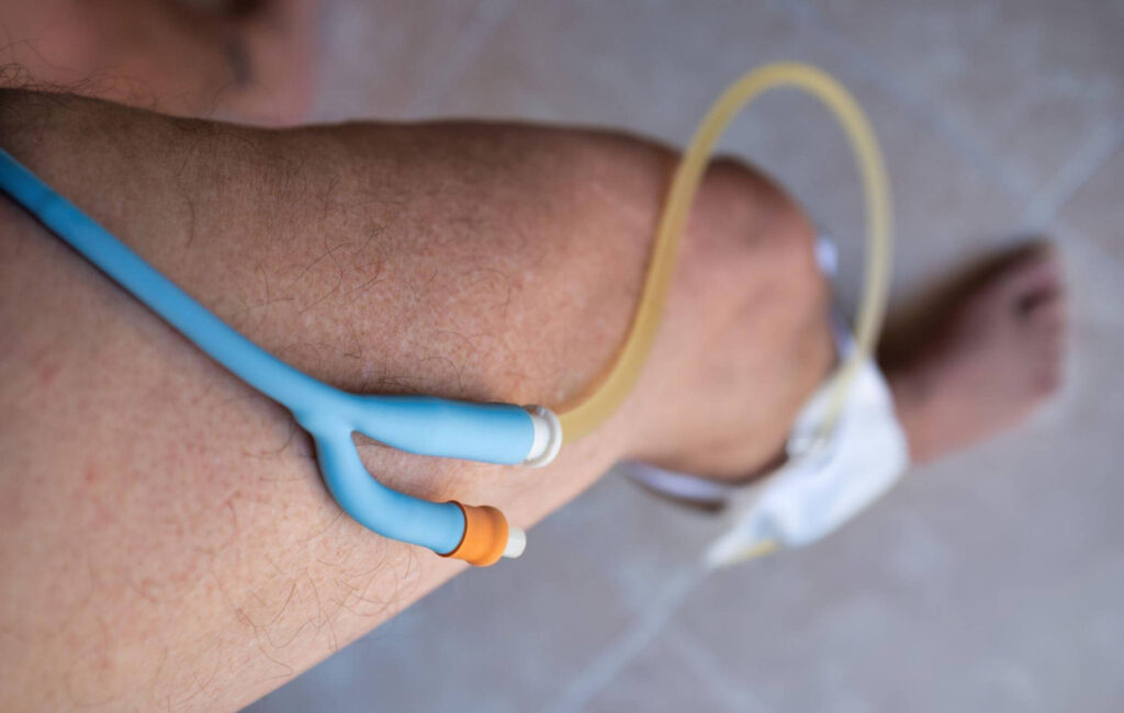 Catheter Management Perth