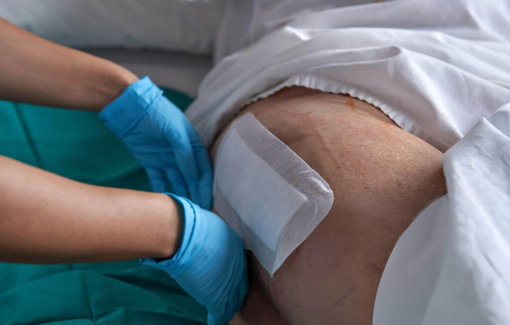 Professional NDIS wound Management in Perth